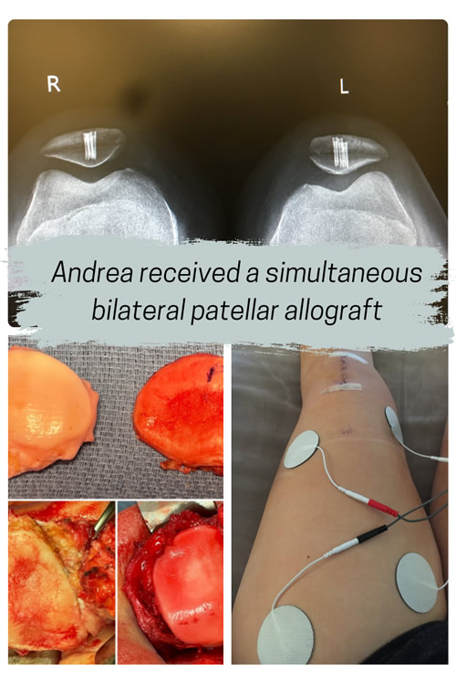 From Surgeon to Surgery Patient